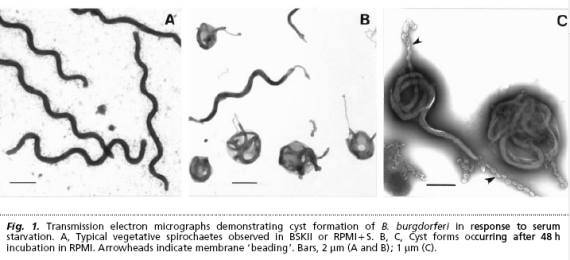 Borrelia-cysts1.png